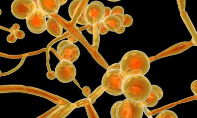 Superfungus: Candida auris, leaves two people hospitalized in Pernambuco
