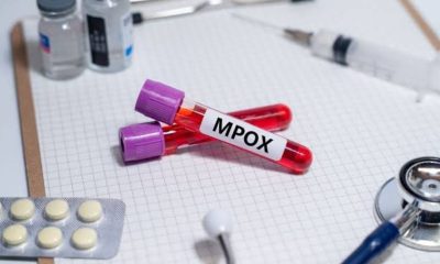 Learn how the Mpox diagnostic test is performed